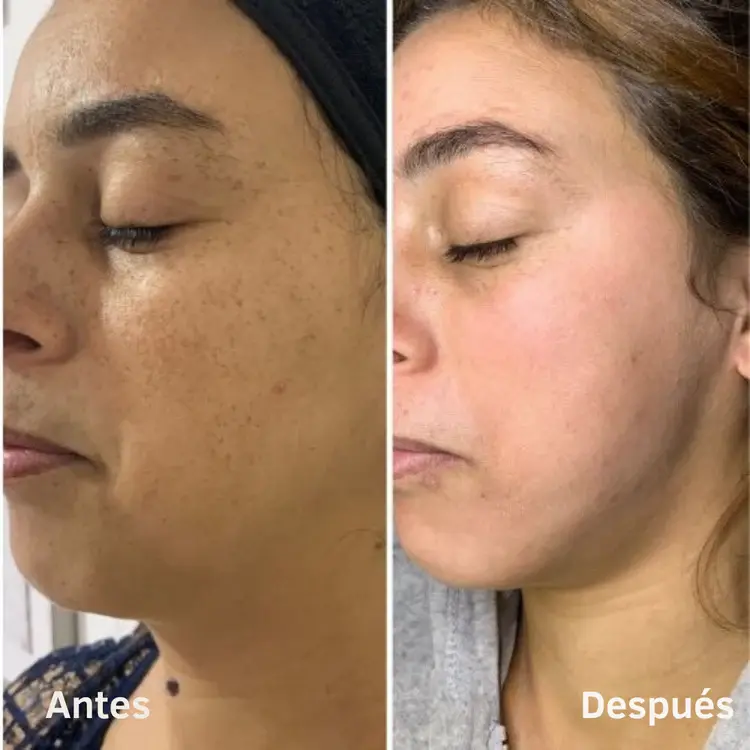 imgi_45_44_6e85bc03-90fe-4672-8dd0-7ed624783ef9